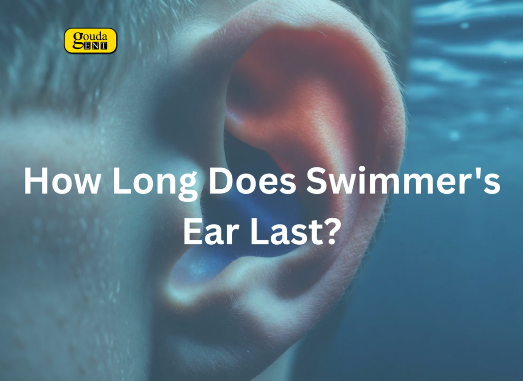 How Long Does Swimmers Ear Last